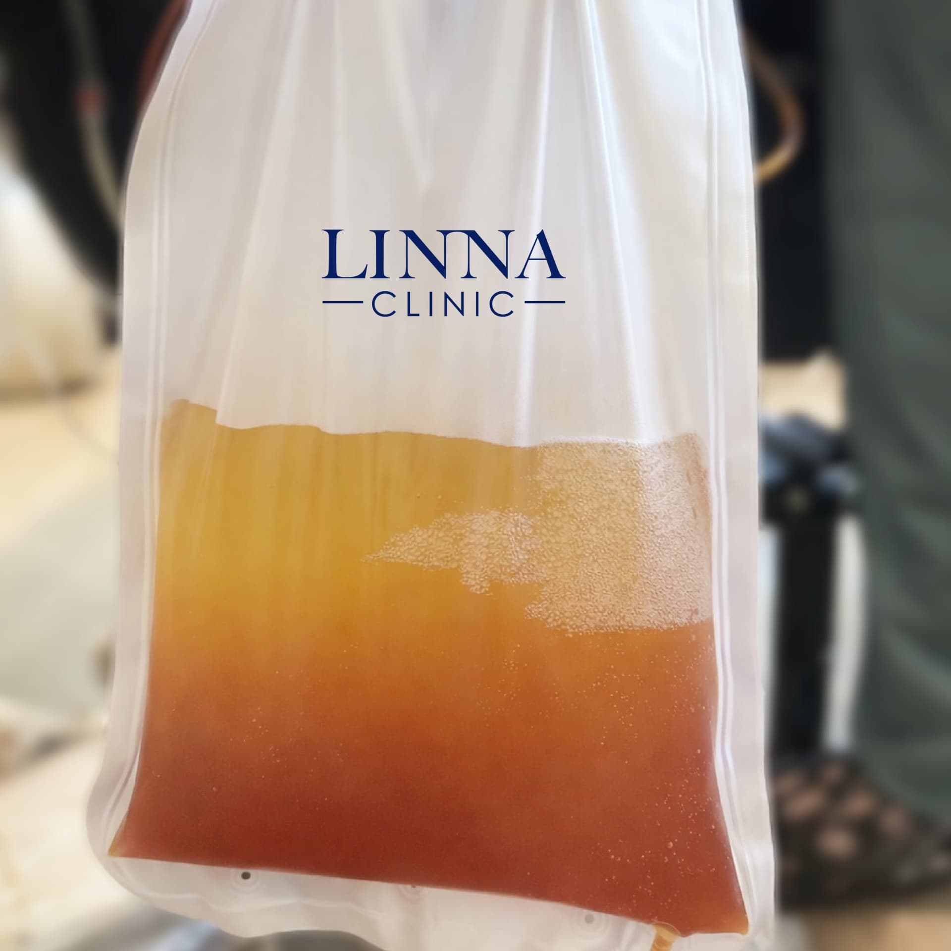 Filtered plasma collected during DFPP treatment at LINNA Clinic