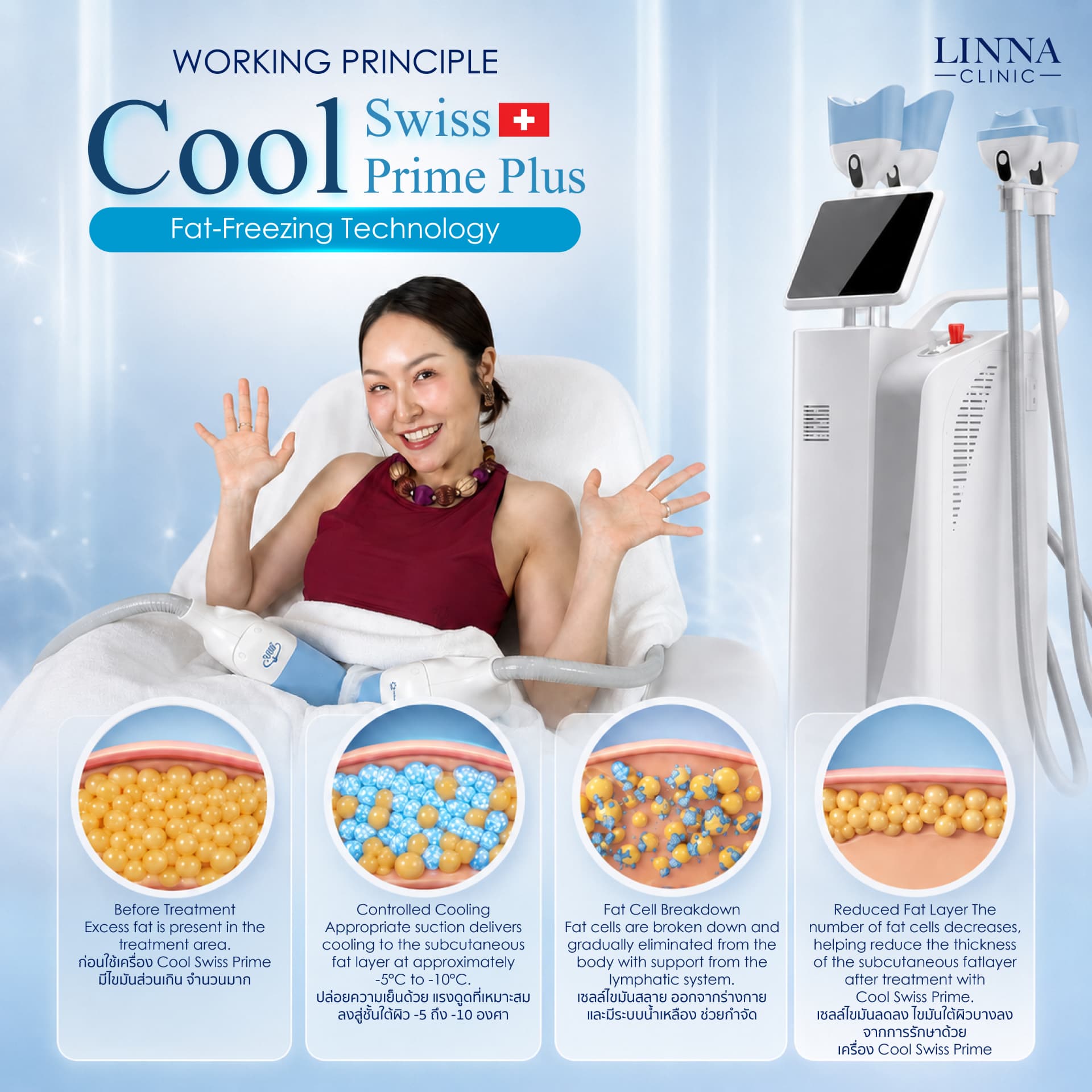 Cool Swiss Prime Plus at LINNA Clinic