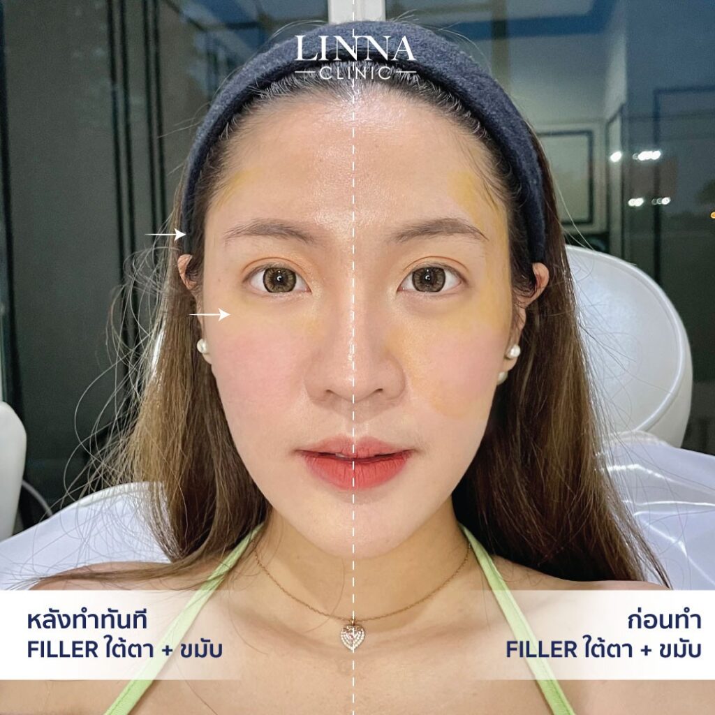Dr. Phrutphailin Tantisinlaphong, M.D. — 7