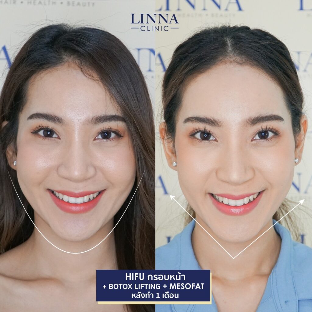 Dr. Phrutphailin Tantisinlaphong, M.D. — 6