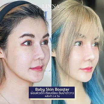 LINNA Clinic treatment result