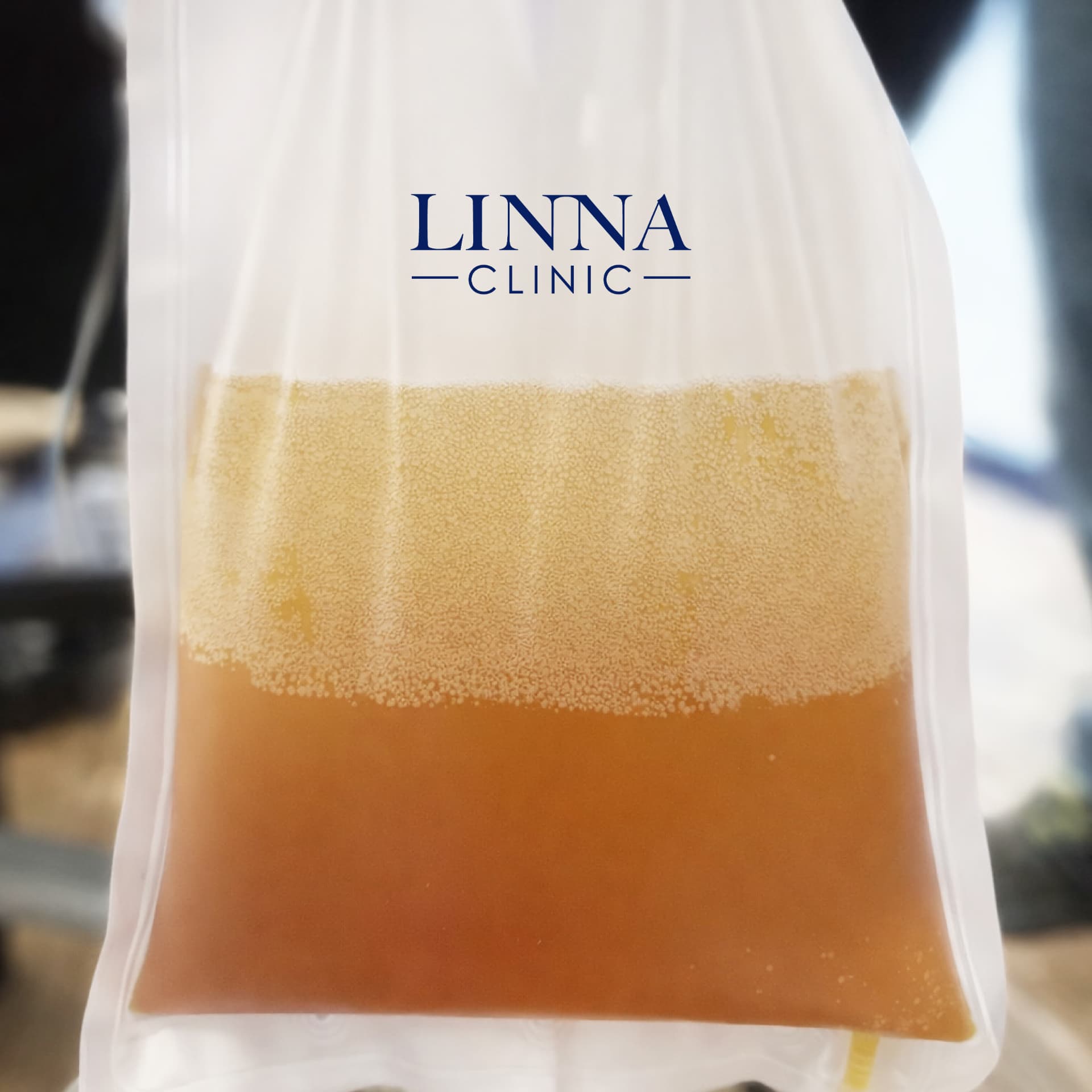 Plasma collected during DFPP treatment at LINNA Clinic