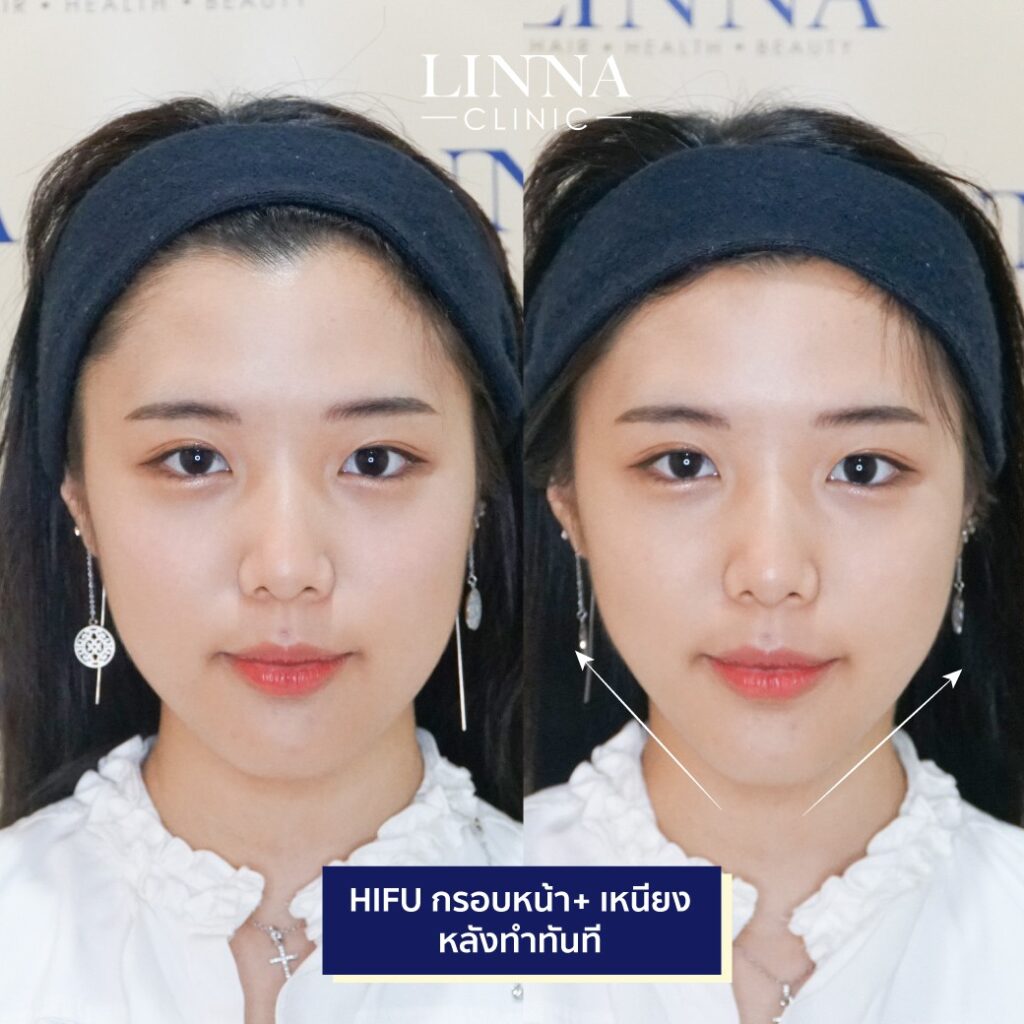 Dr. Phrutphailin Tantisinlaphong, M.D. — 3