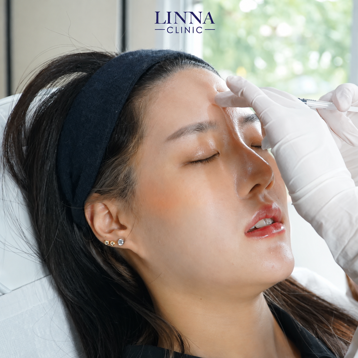 LINNA Clinic Bo ช่วยลดริ้วรอย ปรับรูปหน้าและรูปคิ้ว ไม่มีผลข้างเคียงและไม่ทิ้งสารตกค้างภายในร่างกาย