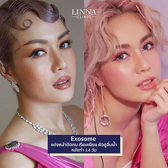 LINNA Clinic treatment result
