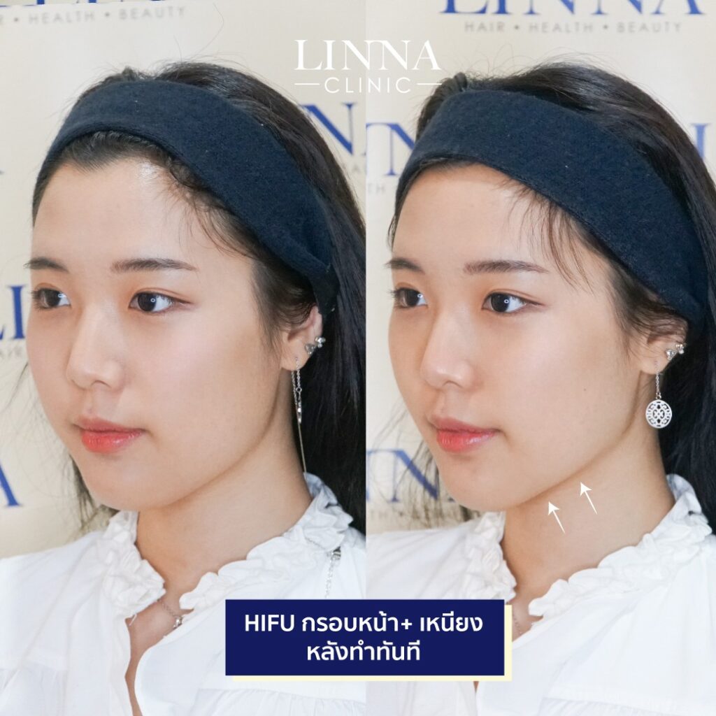 Dr. Phrutphailin Tantisinlaphong, M.D. — 4