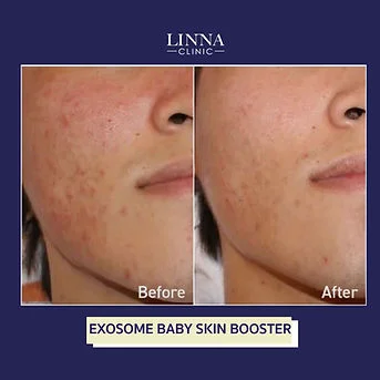 LINNA Clinic treatment result