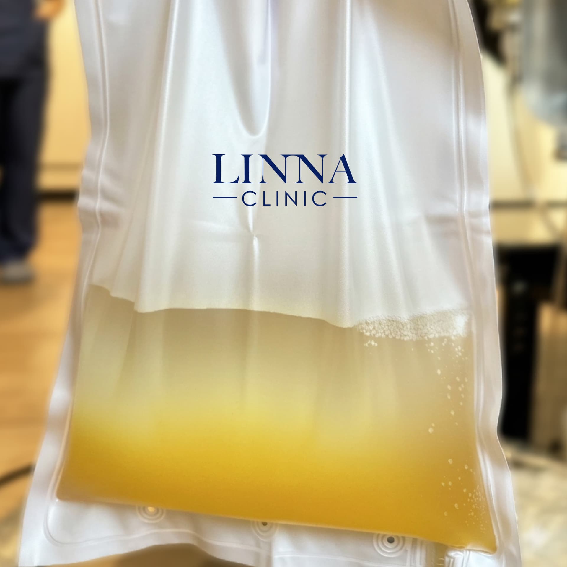 Filtered plasma bag during DFPP at LINNA Clinic