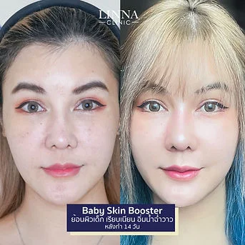 LINNA Clinic treatment result