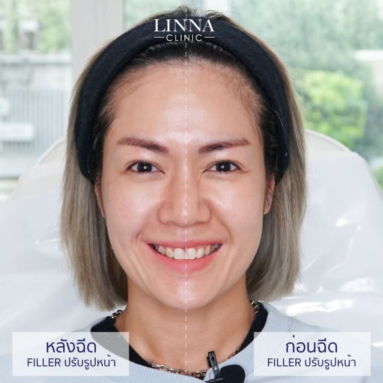 Dr. Tikamporn Yaibuates, M.D. — 1