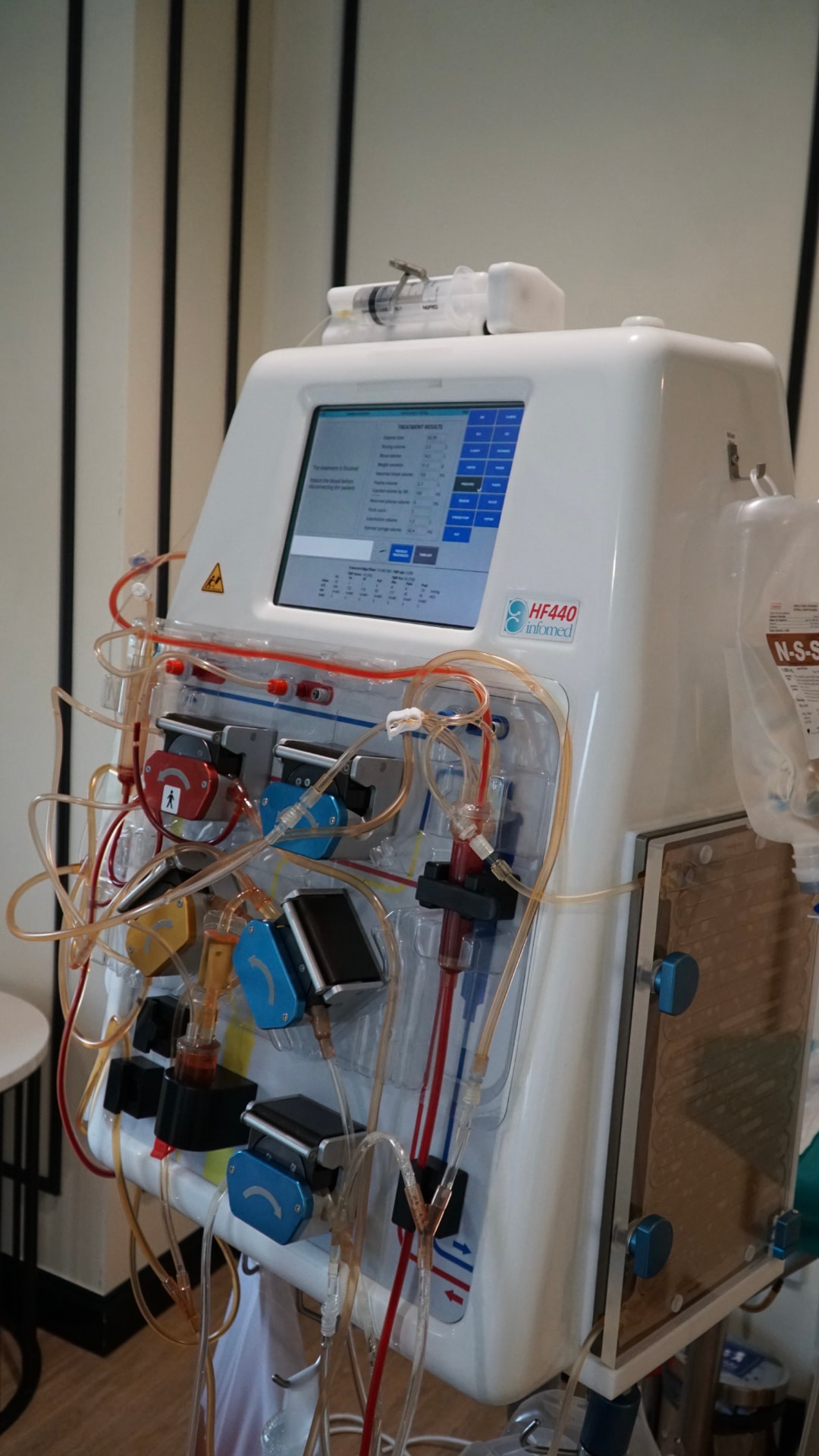DFPP plasma filtration machine used at LINNA Clinic