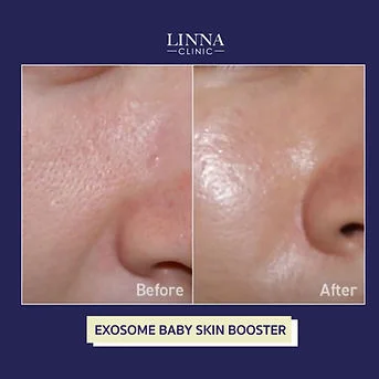 LINNA Clinic treatment result