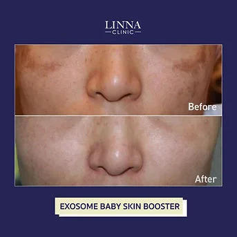 LINNA Clinic treatment result