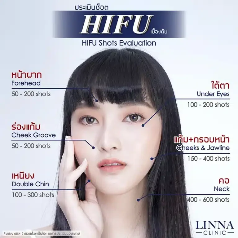 8 ความแตกต่าง LINNA HIFU vs Ultraformer ต่างกันอย่างไร