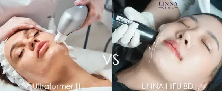 8 ความแตกต่าง LINNA HIFU vs Ultraformer ต่างกันอย่างไร