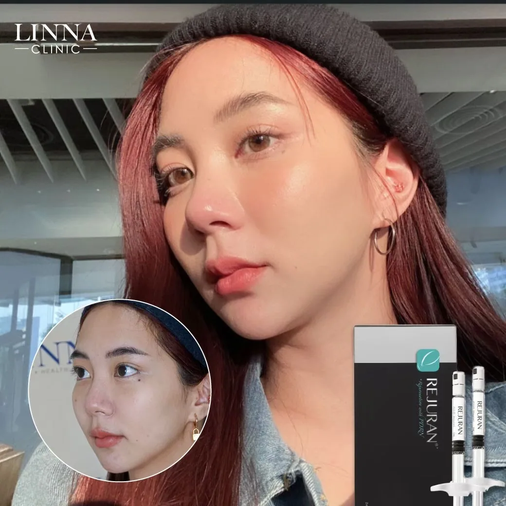 8 หัตถการยอดฮิตประจำปี 2026 ของ LINNA Clinic (ลินนา คลินิก)
