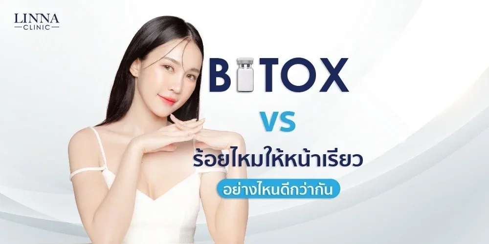 โปรแกรมโบ VS ร้อยไหมให้หน้าเรียว อย่างไหนดีกว่ากัน