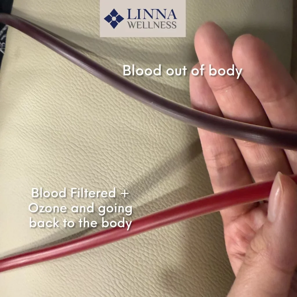 FAQ เกี่ยวกับ EBOO Therapy: รวมคำถามที่พบบ่อยก่อนตัดสินใจทำ