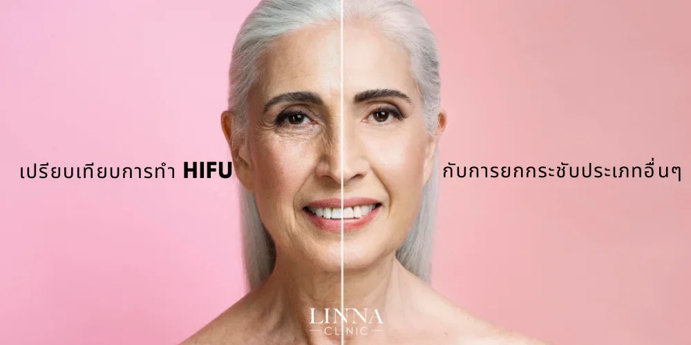 เปรียบเทียบการทำ HIFU กับการยกกระชับประเภทอื่นๆ