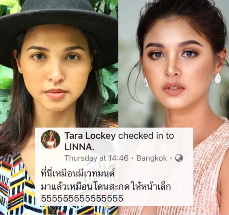 HIFU และ RF ยกกระชับหน้า ต่างกันอย่างไร เลือกทำแบบไหนดี