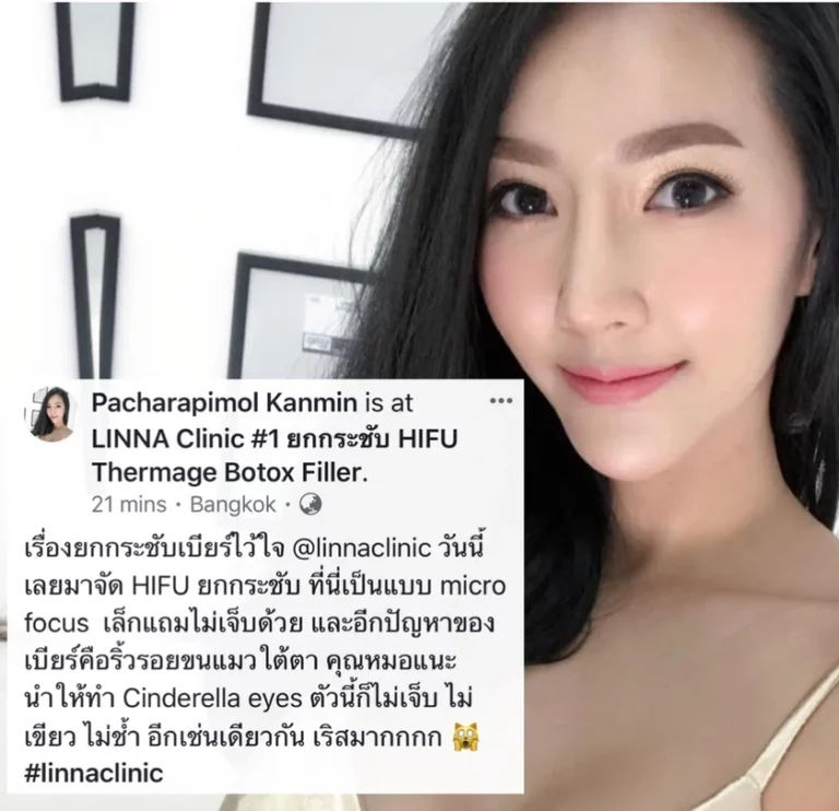 HIFU และ RF ยกกระชับหน้า ต่างกันอย่างไร เลือกทำแบบไหนดี