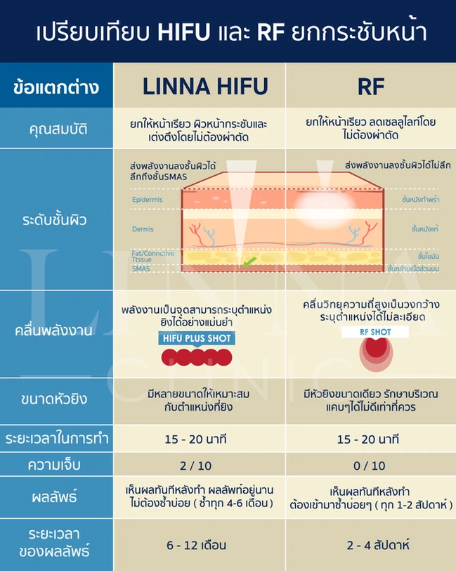 HIFU และ RF ยกกระชับหน้า ต่างกันอย่างไร เลือกทำแบบไหนดี