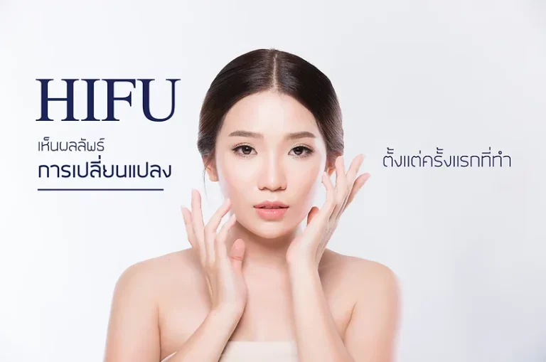 HIFU ทำกี่ครั้งเห็นผล