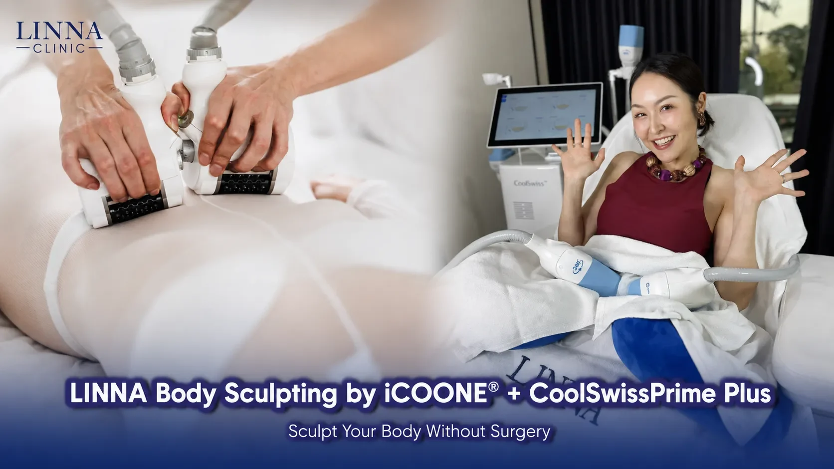 ลดสัดส่วน หุ่นดี ไม่ต้องผ่าตัด ด้วยโปรแกรม LINNA Body Sculpting by iCOONE® + CoolSwissPrime Plus