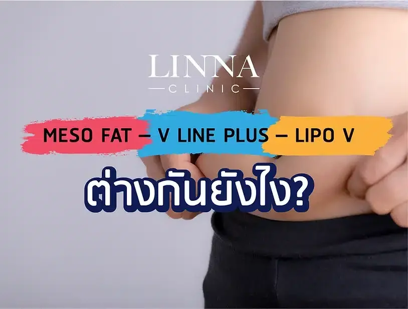 MESO FAT – V LINE PLUS – LIPO V ต่างกันยังไง