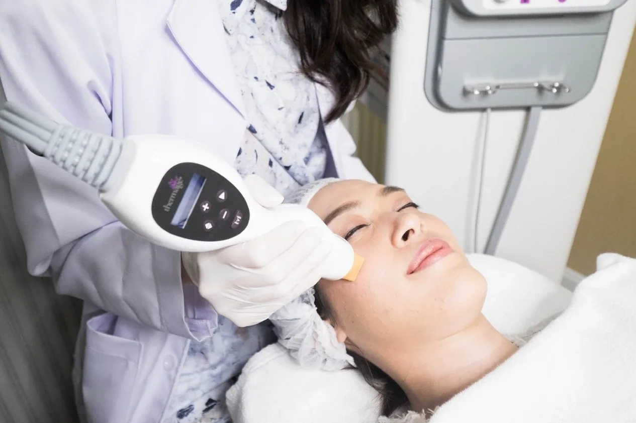 Thermage คืออะไร รวบรวมข้อควรรู้ก่อนทำ Thermage