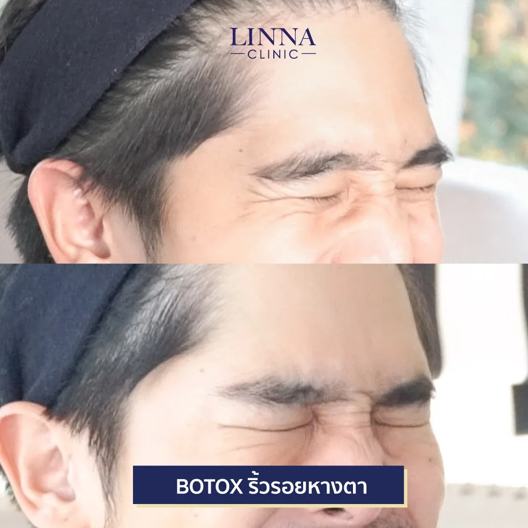Bo ยี่ห้อไหนดี แต่ละตัวต่างกันยังไง มาดูกัน!