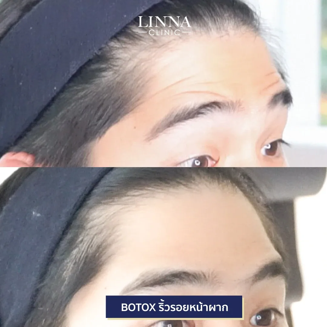Bo ยี่ห้อไหนดี แต่ละตัวต่างกันยังไง มาดูกัน!