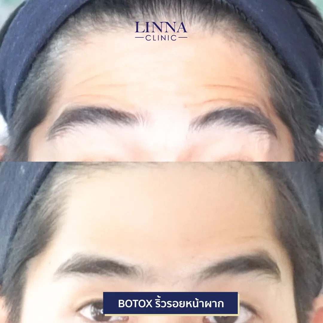 Bo ยี่ห้อไหนดี แต่ละตัวต่างกันยังไง มาดูกัน!