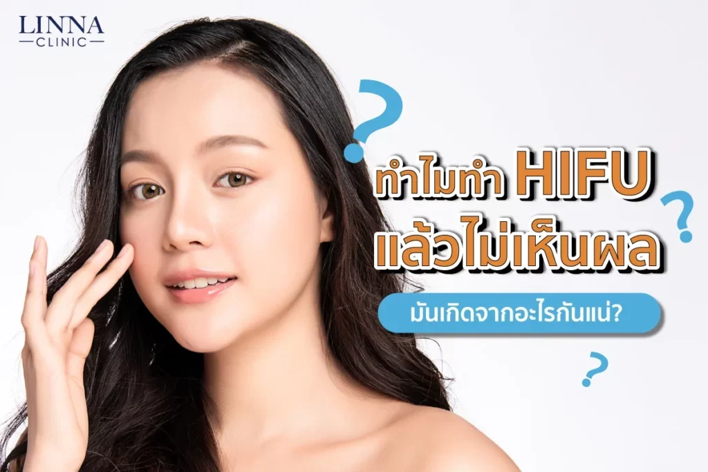 ทำไมทำ HIFU แล้วไม่เห็นผล มันเกิดจากอะไรกันแน่