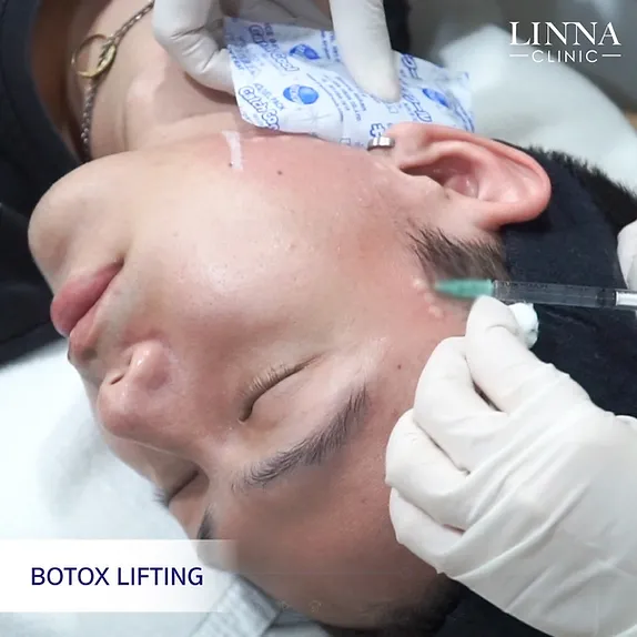 LINNA Clinic Bo ช่วยลดริ้วรอย ปรับรูปหน้าและรูปคิ้ว ไม่มีผลข้างเคียงและไม่ทิ้งสารตกค้างภายในร่างกาย