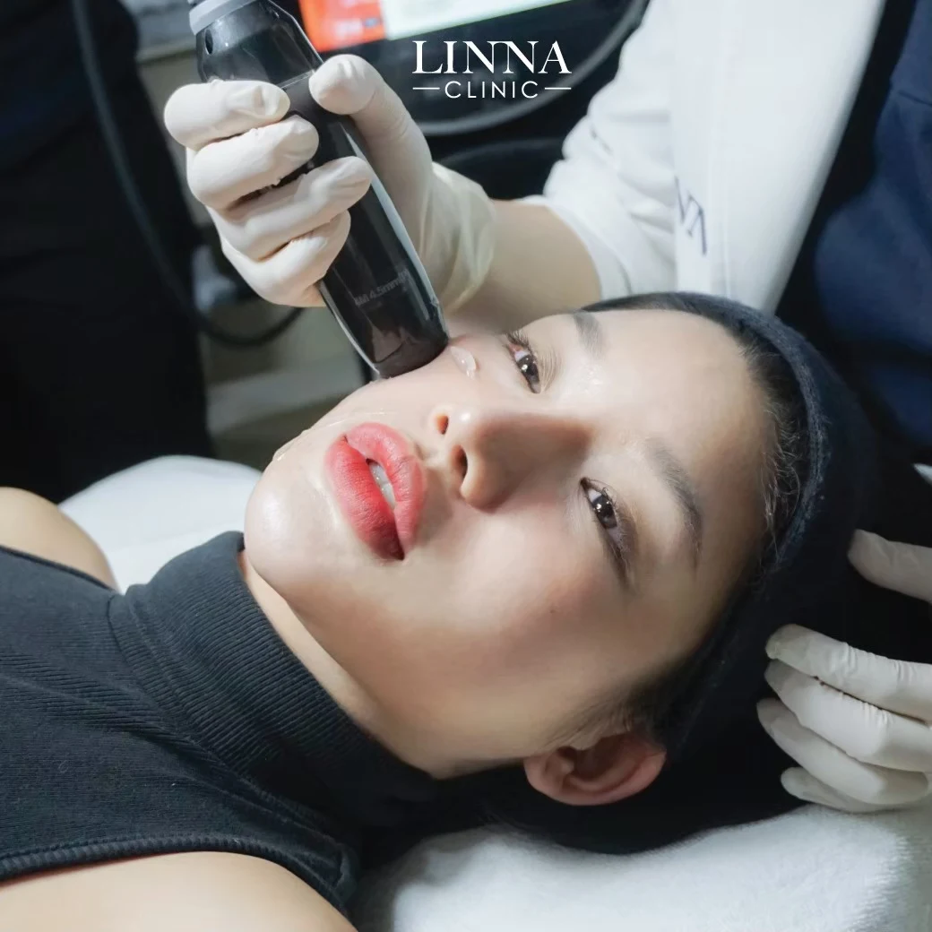 LINNA HIFU 8D treatment
