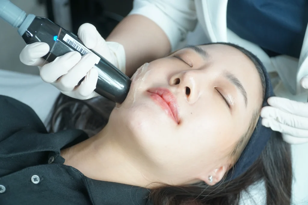 LINNA HIFU 800 shots with Nabota botox treatment at LINNA Clinic Bangkok