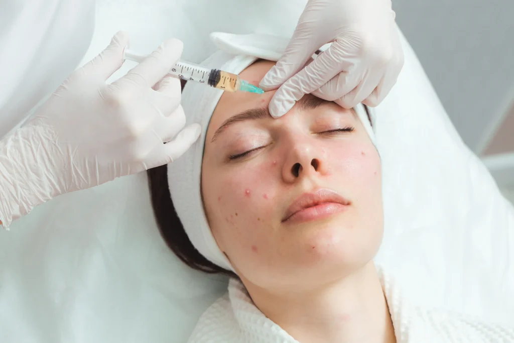 Acne injection treatment for inflamed acne at LINNA Clinic Bangkok