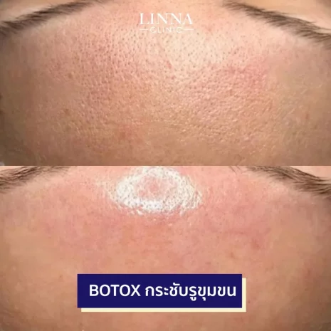 Skintox