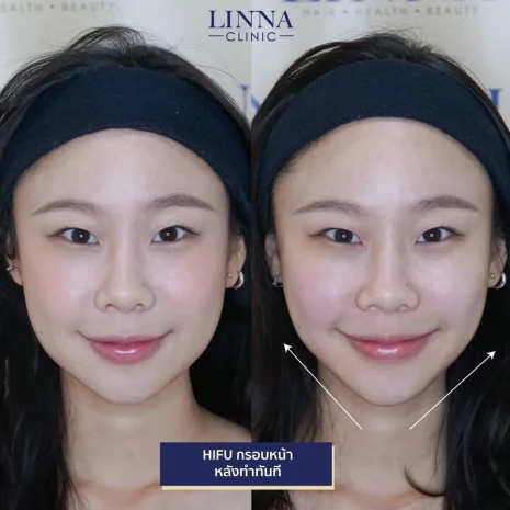 คุณต้นหลิว